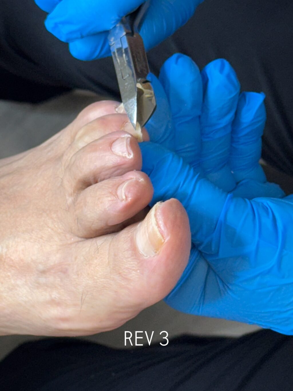 Instagram post from pedicuristaslizanaya. This post is in position 1.